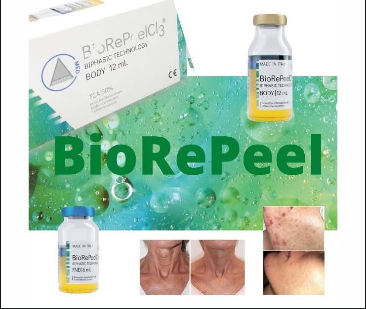 BioRePeel 
